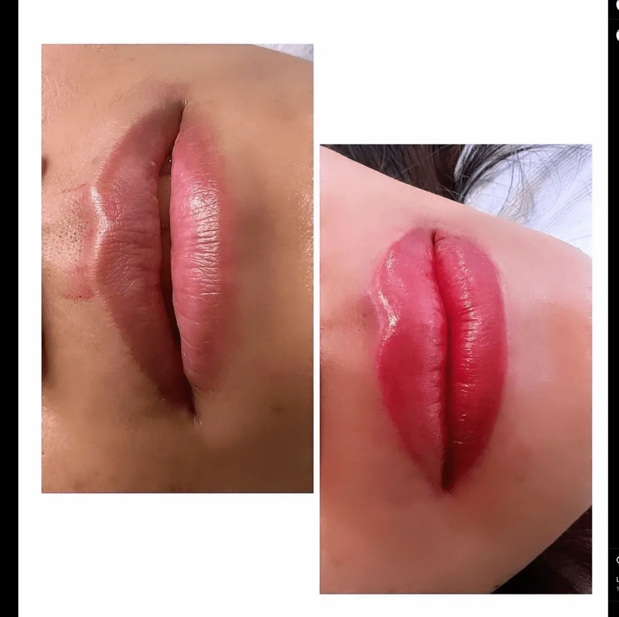 Saline Removal Lip Blush